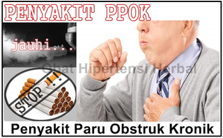 Illustration for article titled Mengobati Penyakit Paru Paru PPOK Menggunakan Tumbuhan Herbal